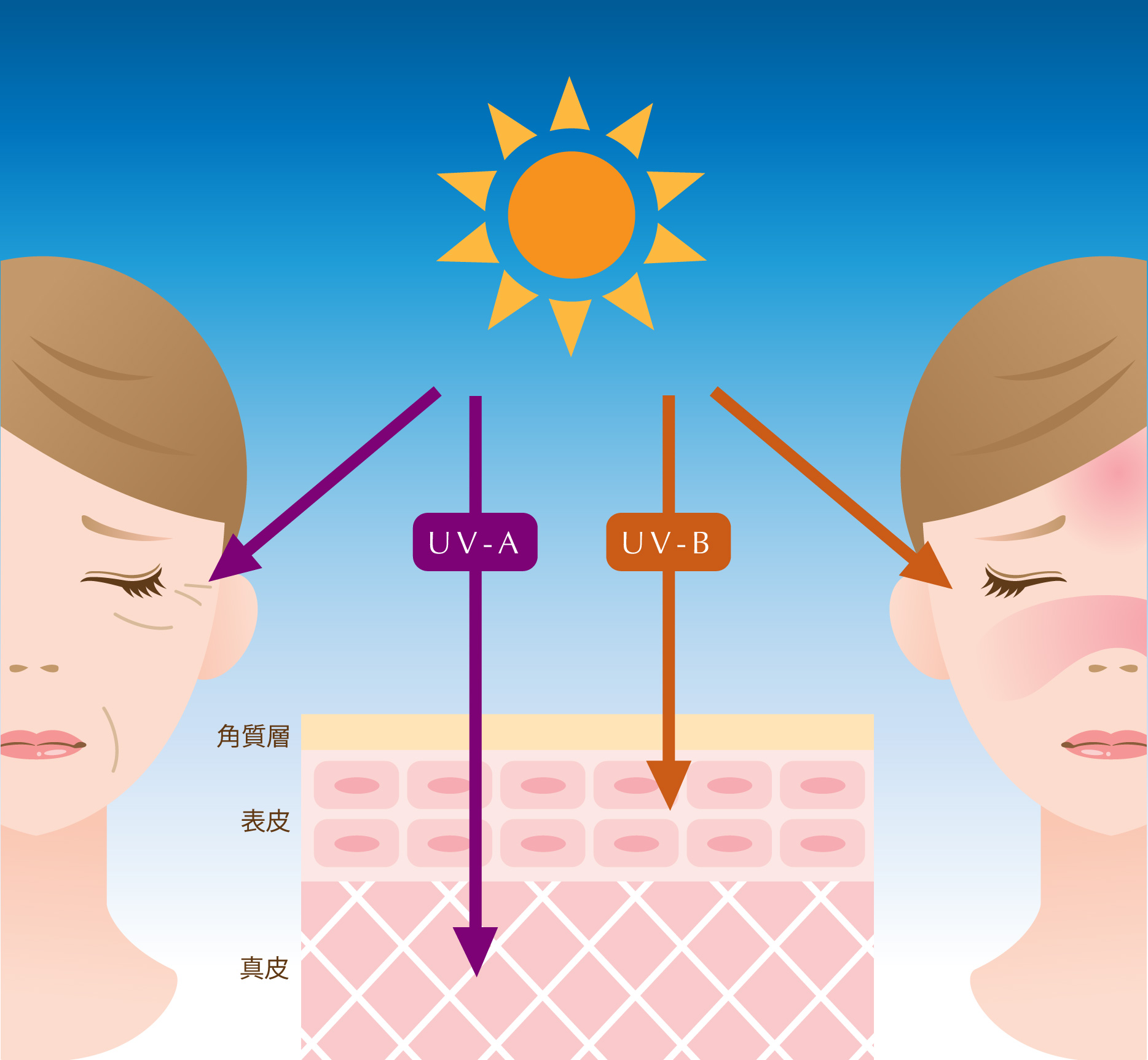 紫外線ダメージの説明画像